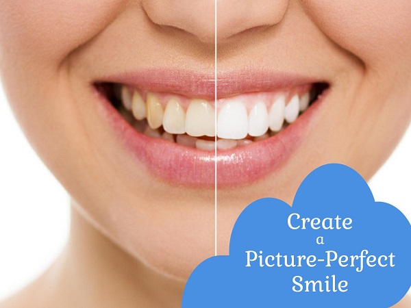 Woman smiling after porcelain veneers treatment by Aesthetic Dental Studio