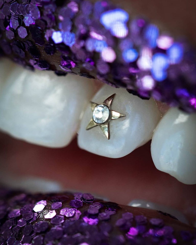 La Stella Bocca di Moda tooth gem in Calgary