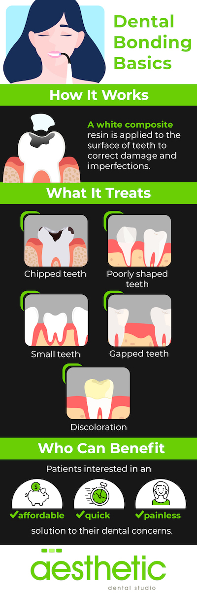 Dental bonding basics
