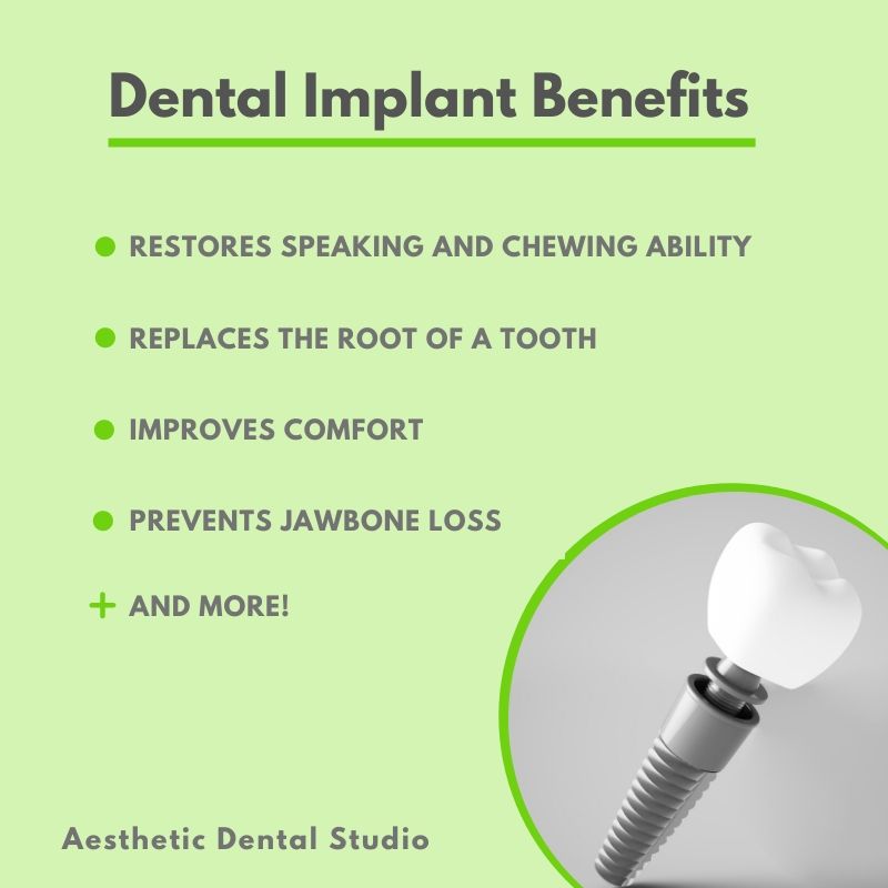 Benefits of dental implants in Calgary, AB