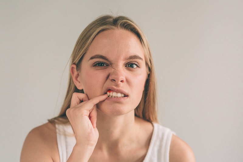 Woman with gum disease in Calgary