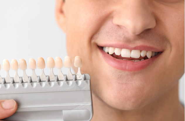 Man with teeth color samples on light background