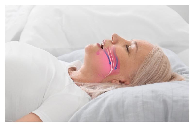 Sleep Apnea Treatments Alberta CA