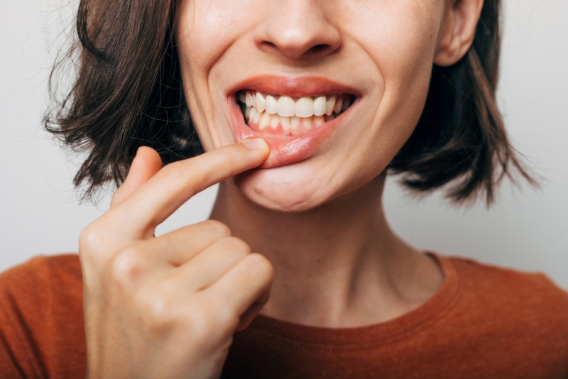 Woman smiling showing her healthy gums from scaling and root planing in Calgary, Canada