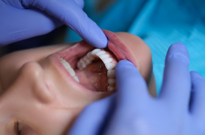 Woman having her mouth examined for oral cancer at the dentist in Calgary