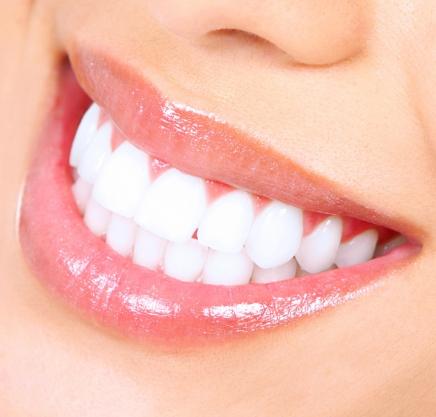 Close up of white teeth after Zoom Teeth Whitening treatment in Calgary