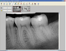 Calgary Digial X-Rays Image