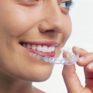 Invisalign in Calgary