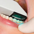 iTero - superior dental restorations in Alberta