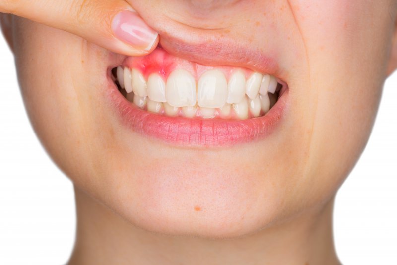 gum disease