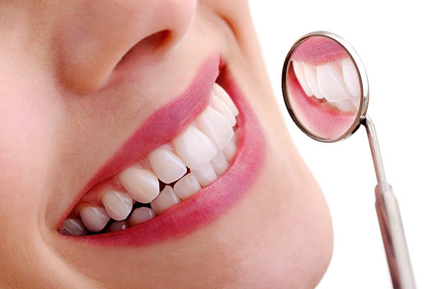 Smile Treatment