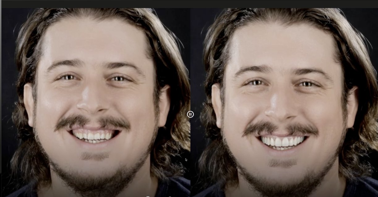 Virtual Smile Transformation