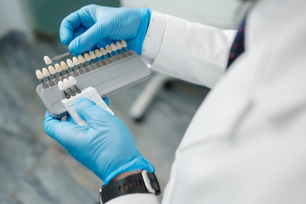 Top eight Smile Problems Dental Veneers Can Fix
