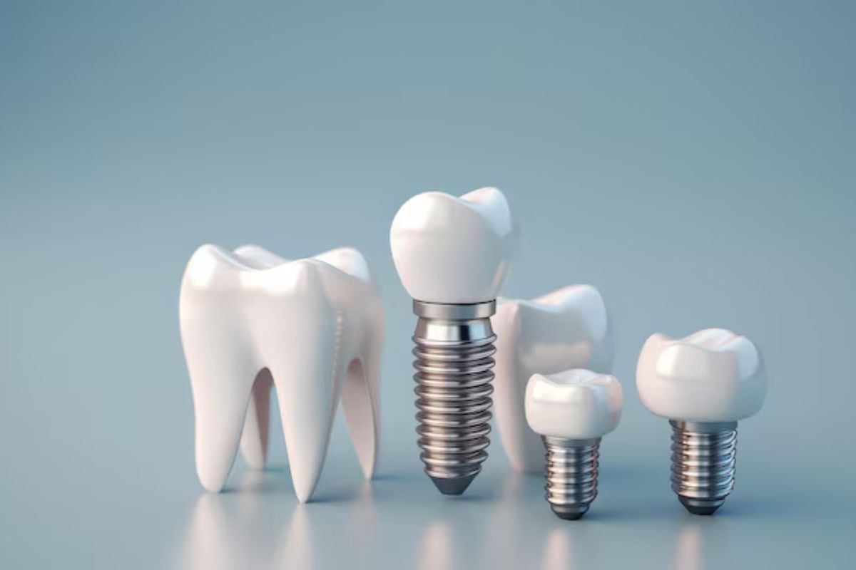 dental implants for permanent and natural-looking tooth replacement