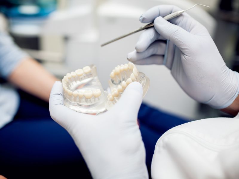 best foods to eat with a dental bridge complete guide